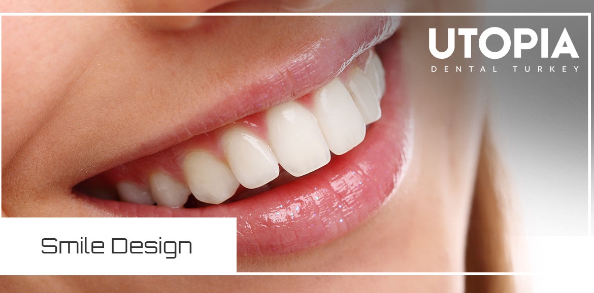 Get the Smile you’ve always wanted with a smilemakeover in Turkey